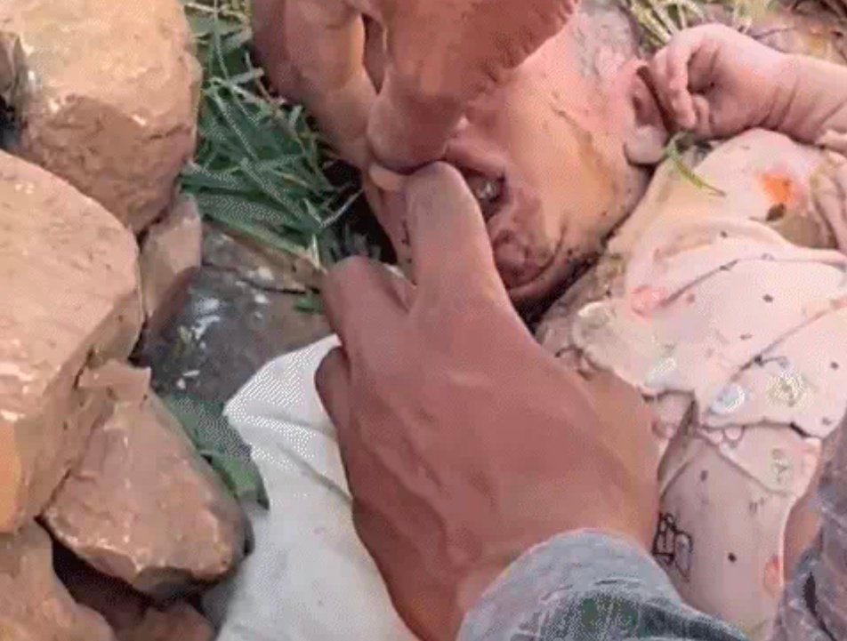 शर्मशार घटना,मुंह में पत्थर ठूंसकर बच्चे को जंगल में फेंका, रोने की आवाज नहीं आए, इसलिए फेवीक्विक लगाया; जलाने के भी निशान मिले